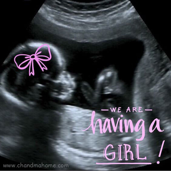 عکس سونوگرافی جنین دختر