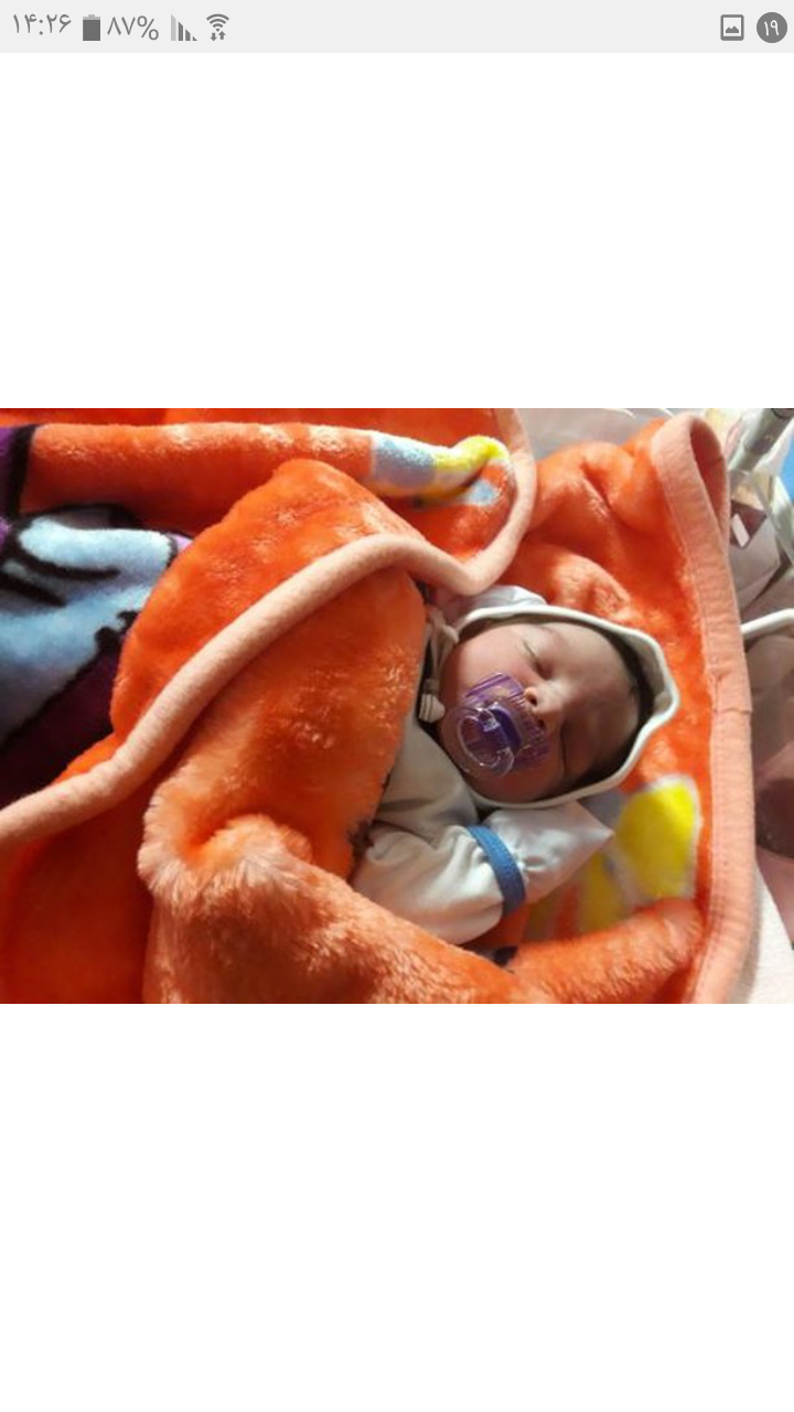 متولد شدن نوزاد ارتین اشکواری