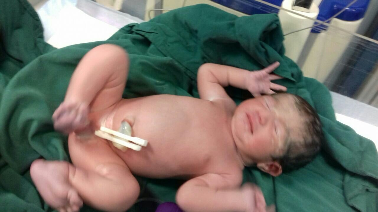 متولد شدن نوزاد گیسو ملکی