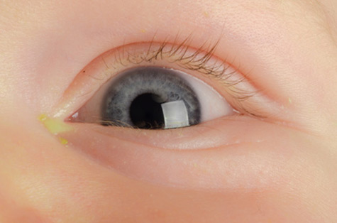 تصویر رشد نوزاد در 5 ماه و 2 هفتگی : معاینه چشم‌های نوزاد شما 
