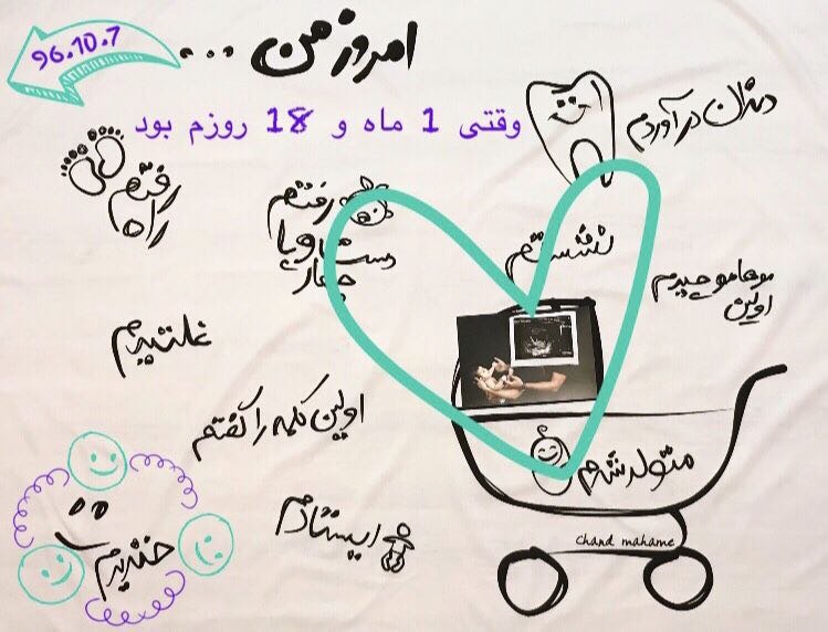 پارچه خاطره ها هیراد پورعسگری