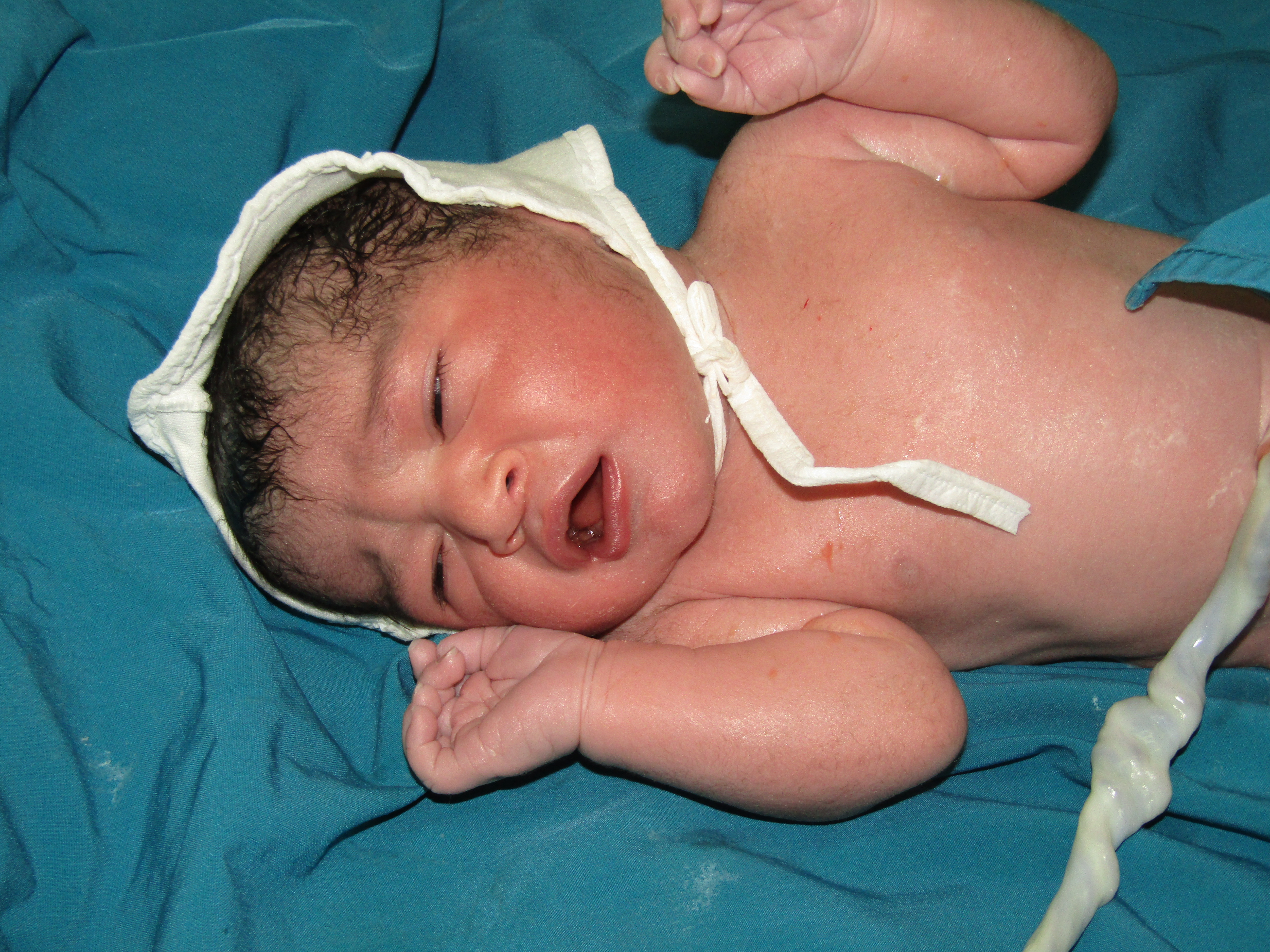 متولد شدن نوزاد دلوان میرزایی