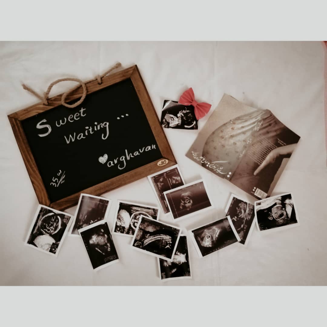 شش ماهگی نوزاد ارغوان عبداله زاده