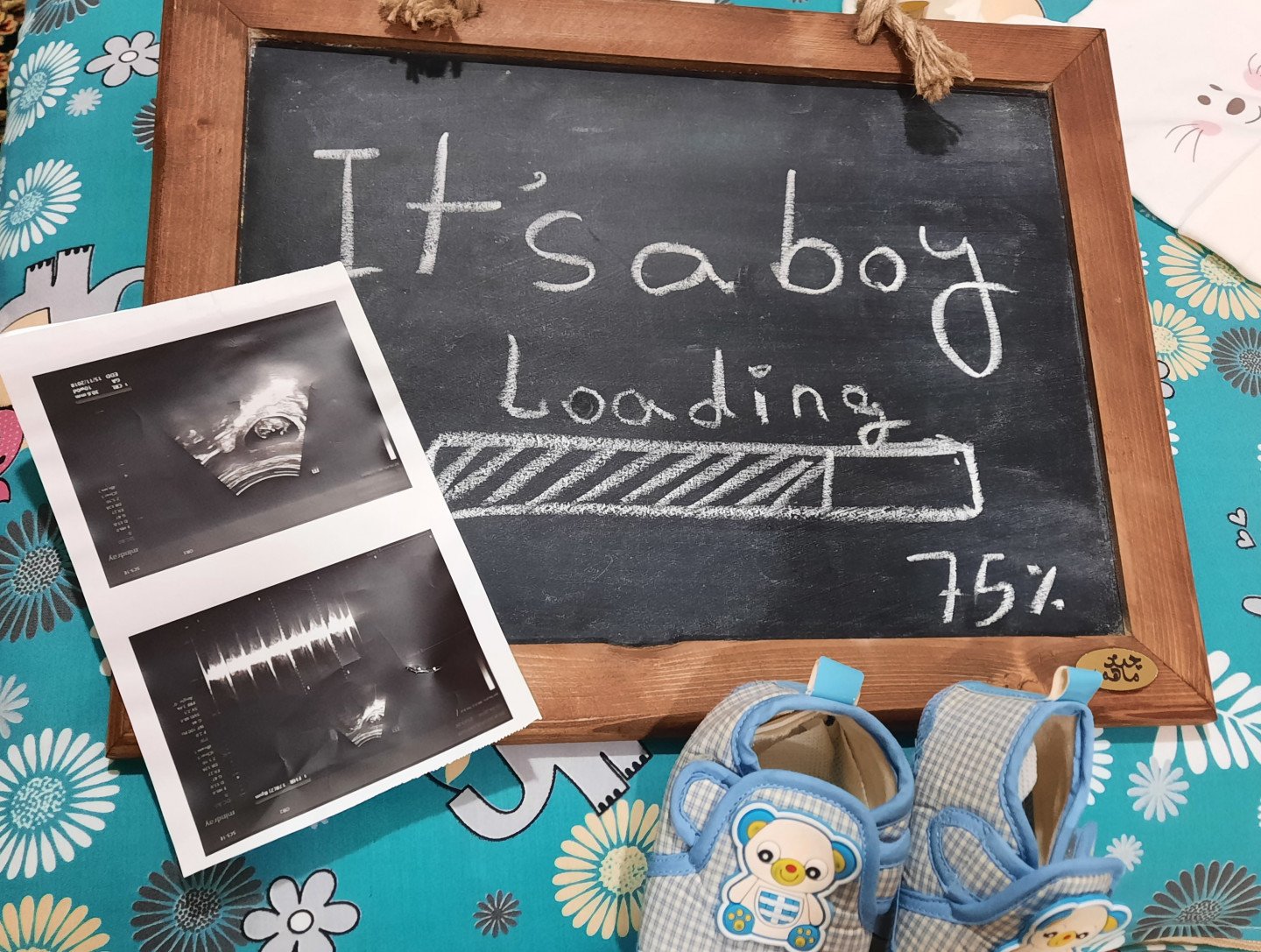 نوزده ماهگی کودک سورنا حبیبی