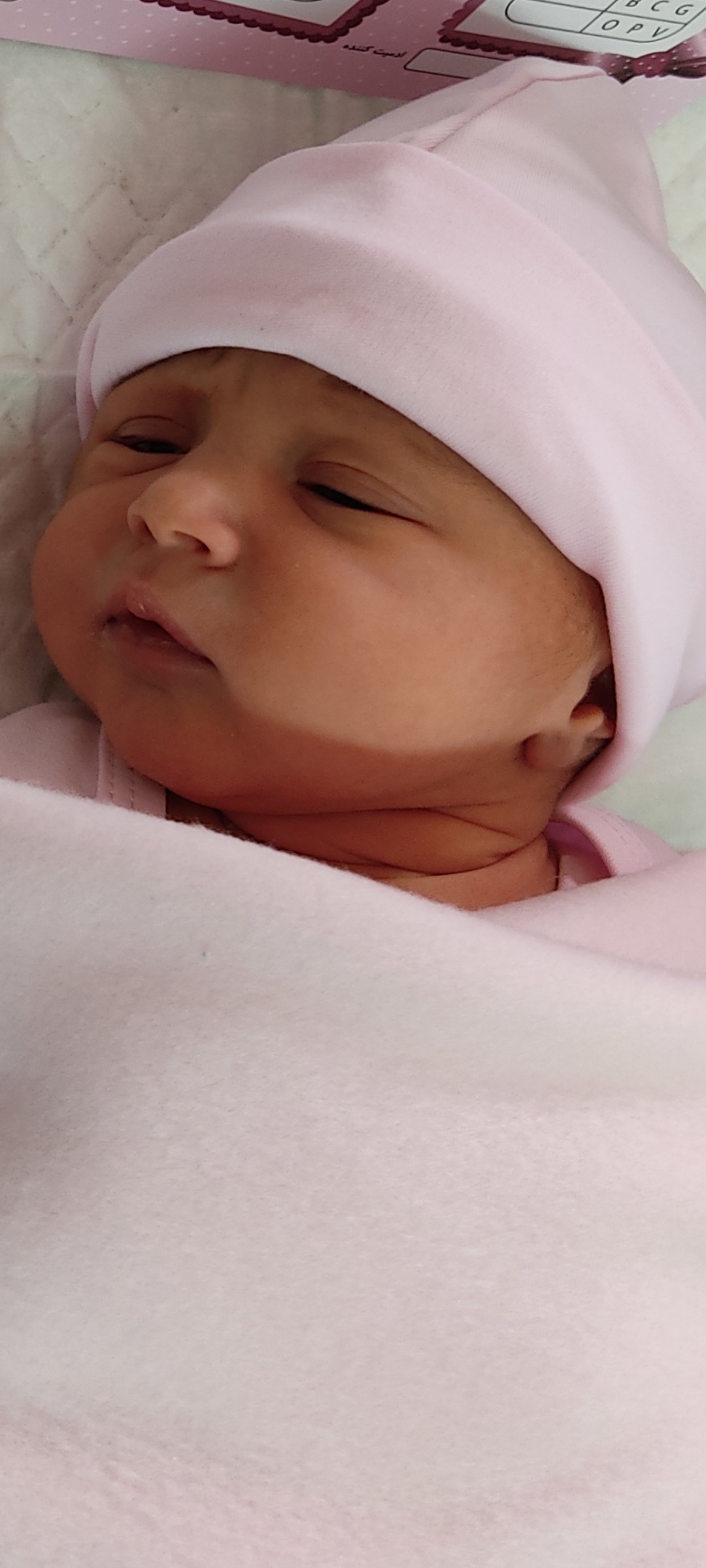 متولد شدن نوزاد اِلآی  فتح الهی