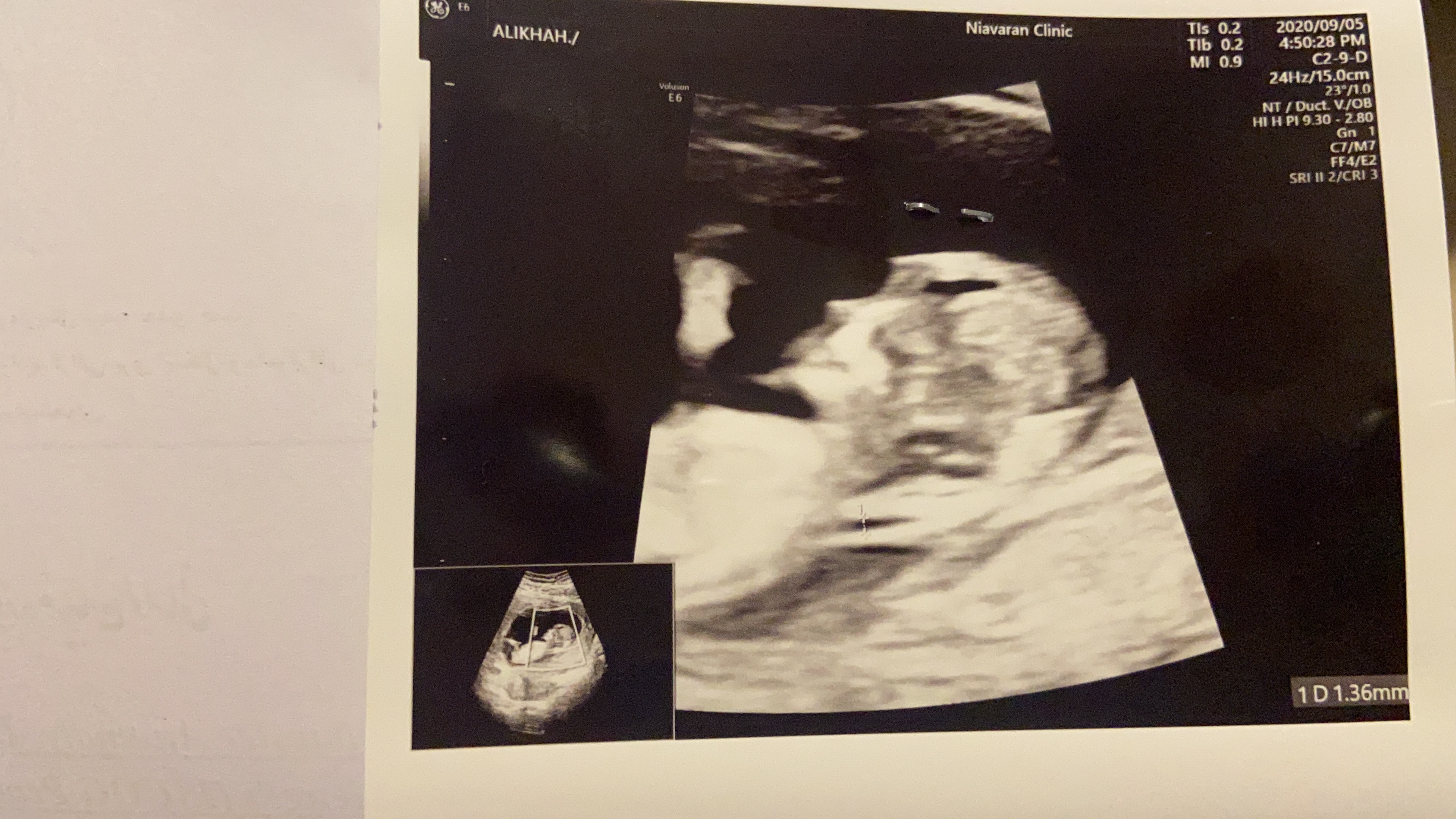 متولد شدن نوزاد ..