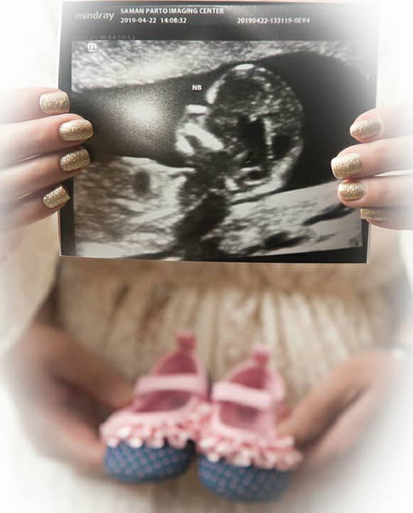 متولد شدن نوزاد نفس قیومی