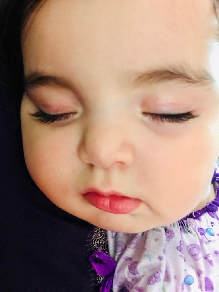 دوازده ماهگی نوزاد جانان نیک فرجام