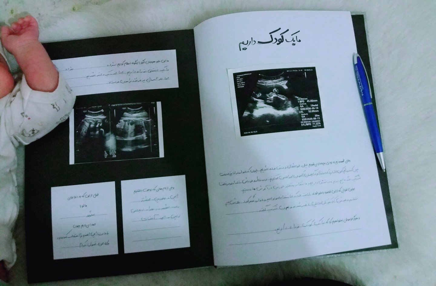 یک ماهگی نوزاد بنین حمیدی