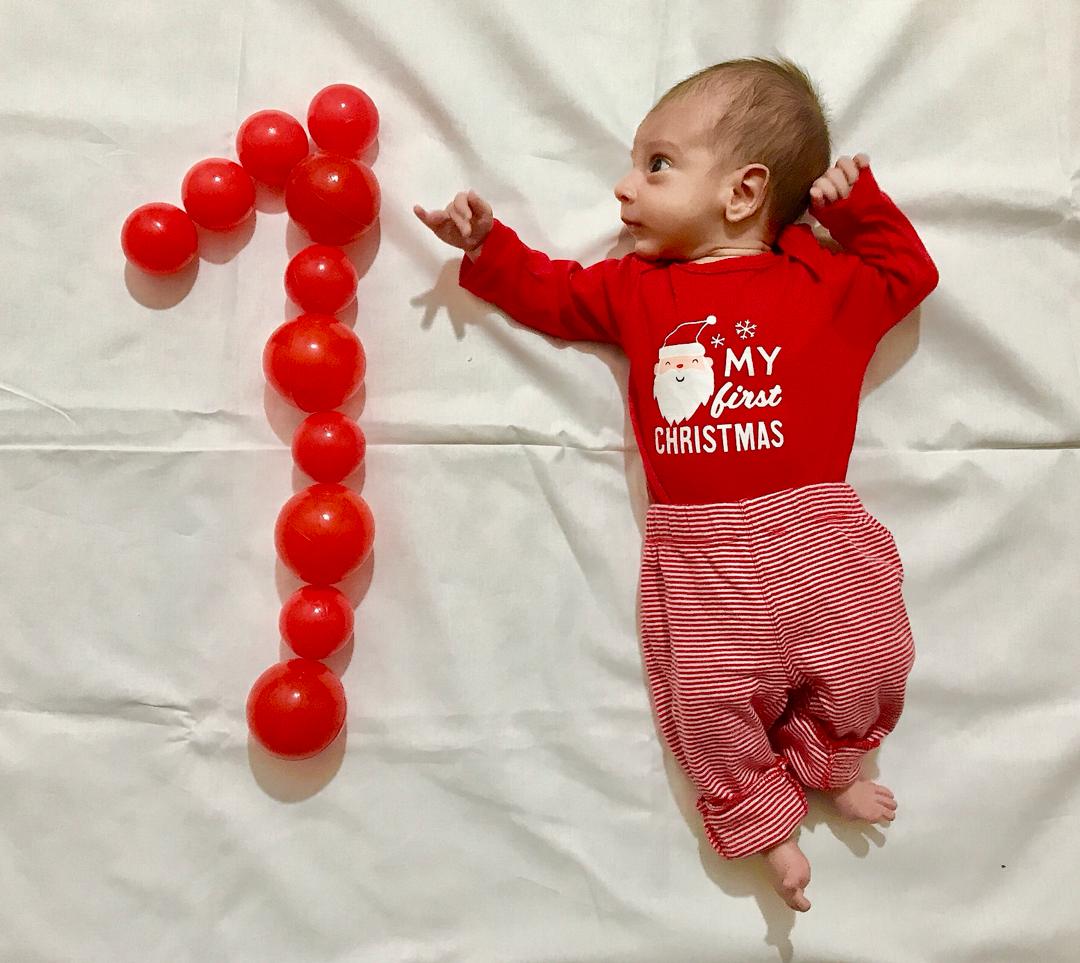 یک ماهگی نوزاد ابتین قیصری