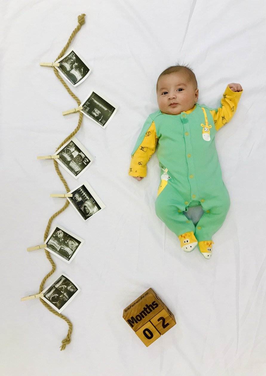 یک ماهگی نوزاد رایان فلاحتکار