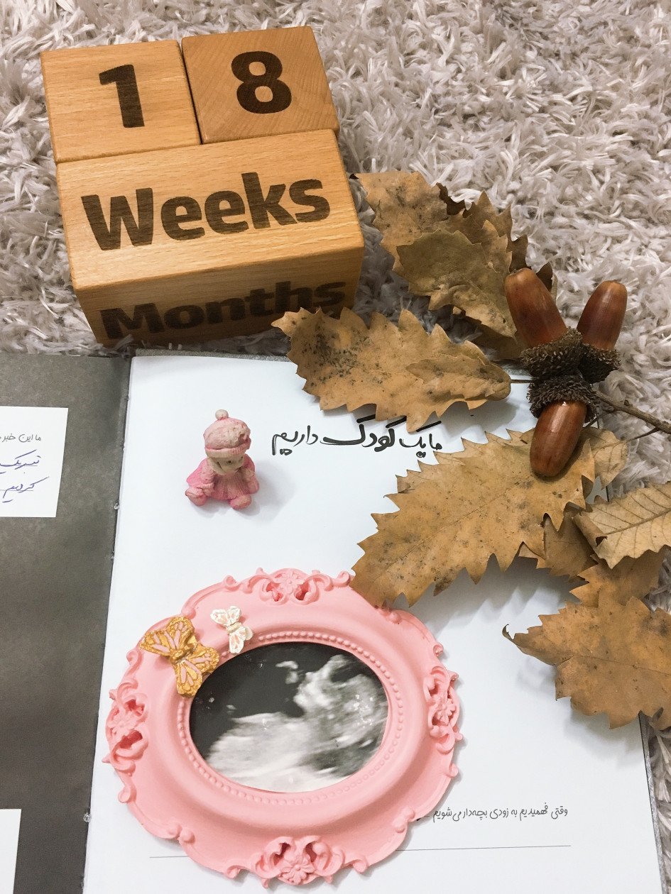 آلبوم خاطرات کودکی دلوین قلی نژاد