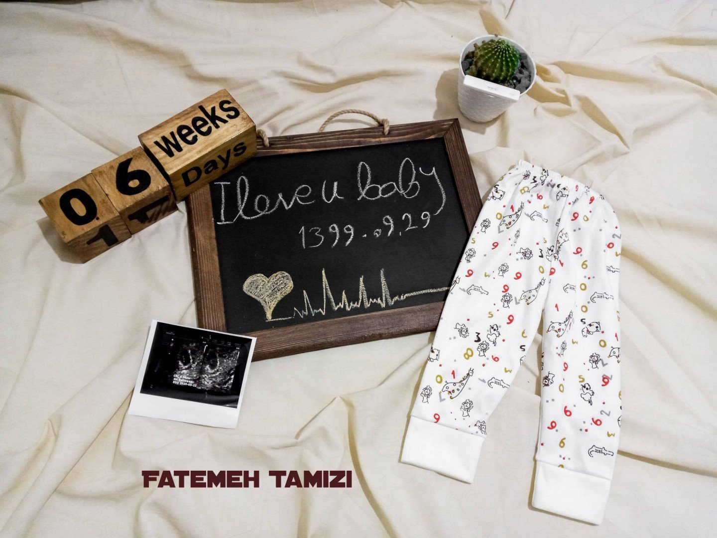 یک ماهگی نوزاد کرامتی