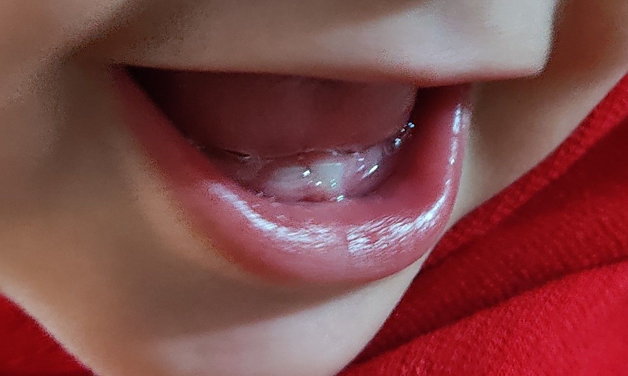 جشن دندونی نوزاد شاهان ضیائی