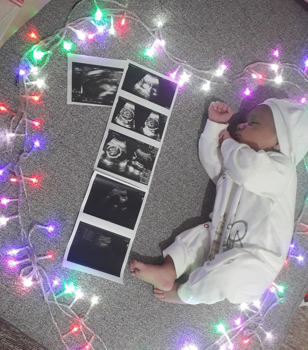 یک ماهگی نوزاد هامون سلطانی