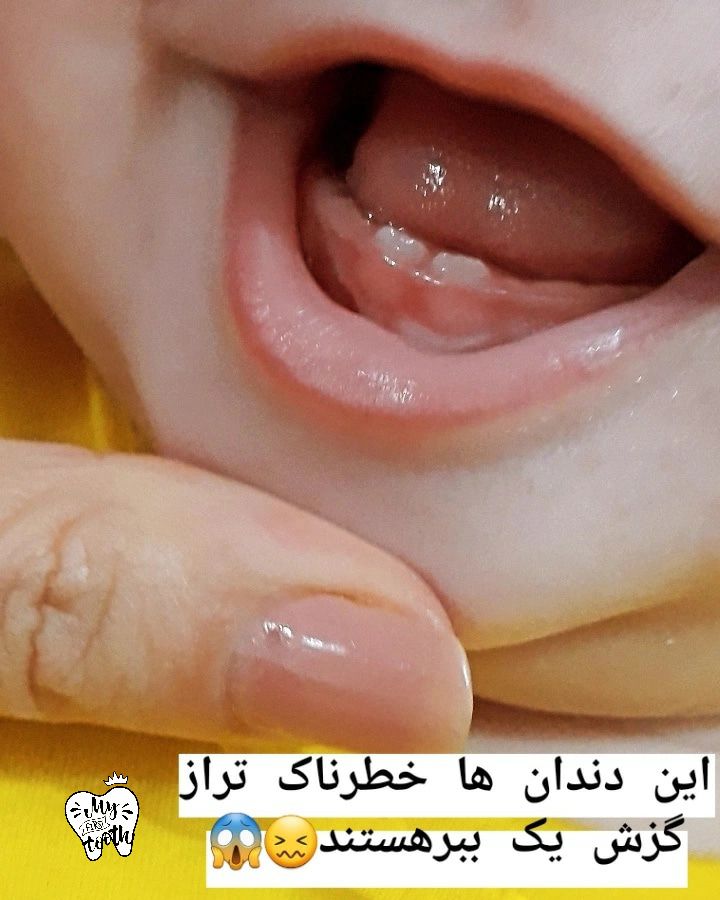 جشن-دندونی پناه شاخص