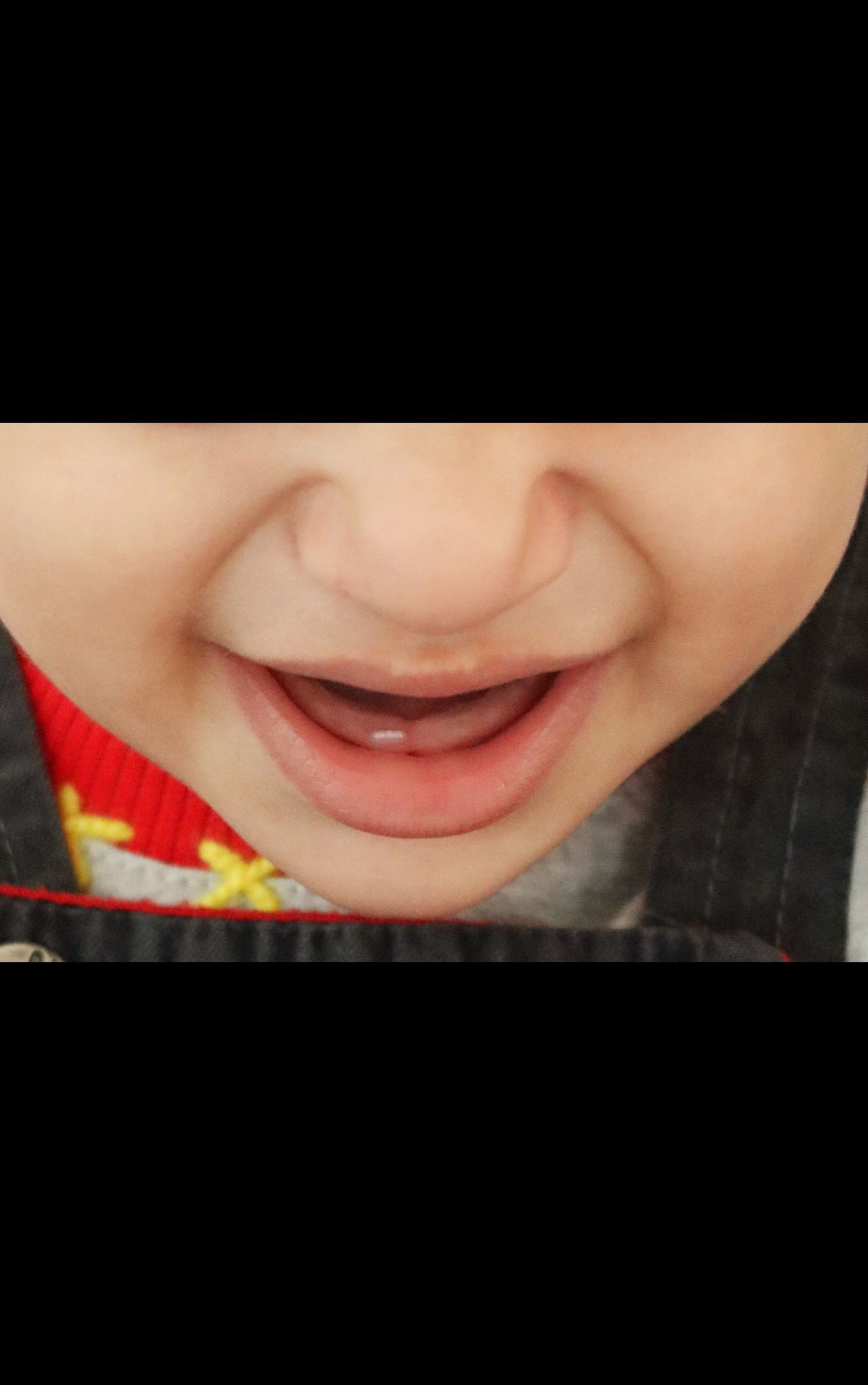 دندان-درآوردن کیان قدیانی