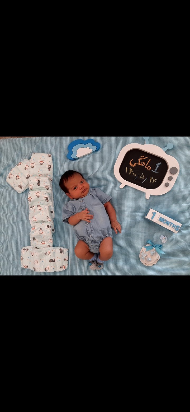 یک ماهگی نوزاد رادمهر فیوژ