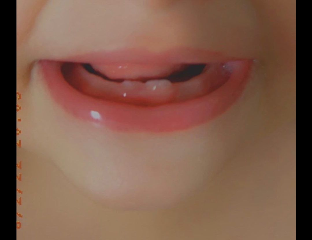 دندان-درآوردن جانان خدائی