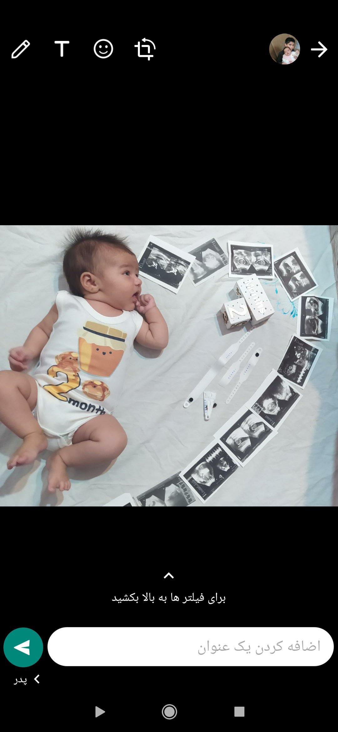 اولین خنده نوزاد همتایزدانی