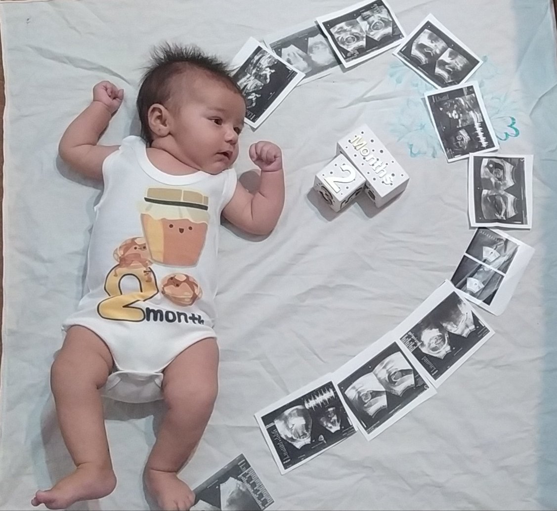 اولین خنده نوزاد همتایزدانی