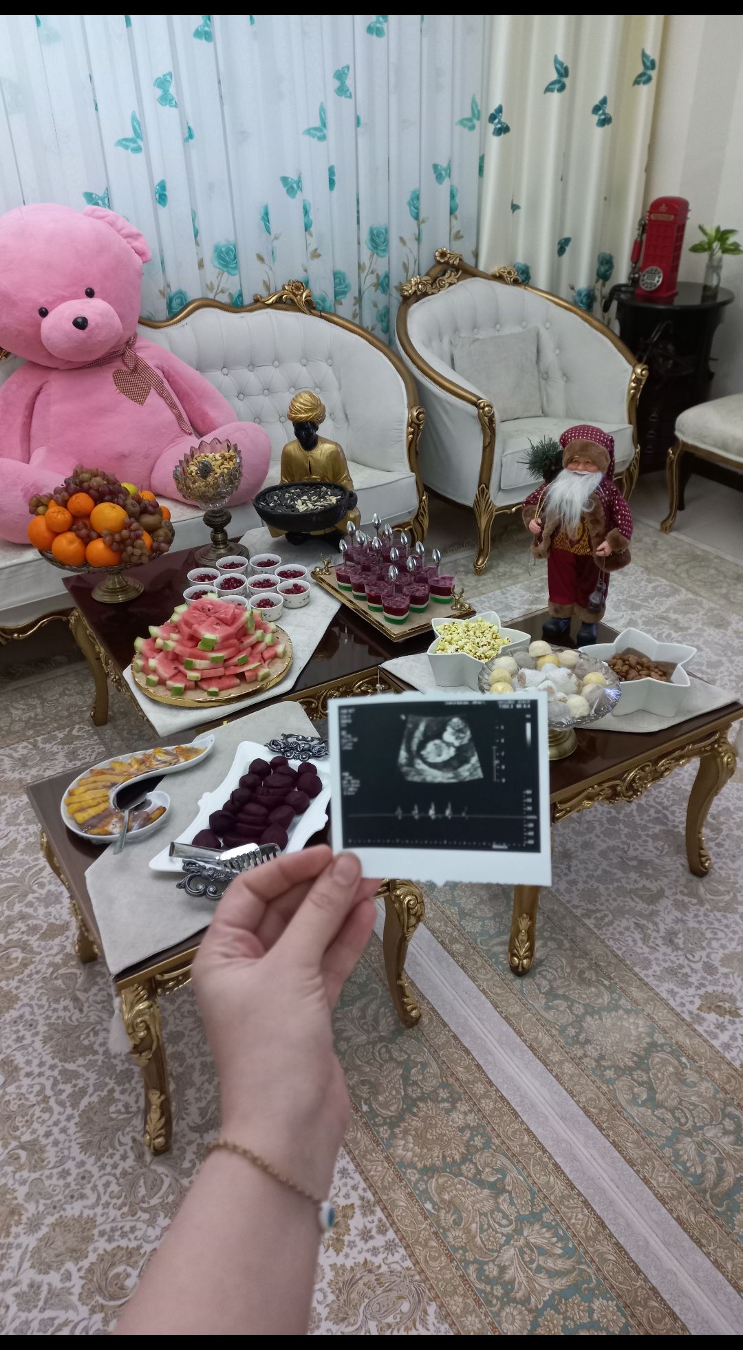 سونوگرافی آکای خجسته