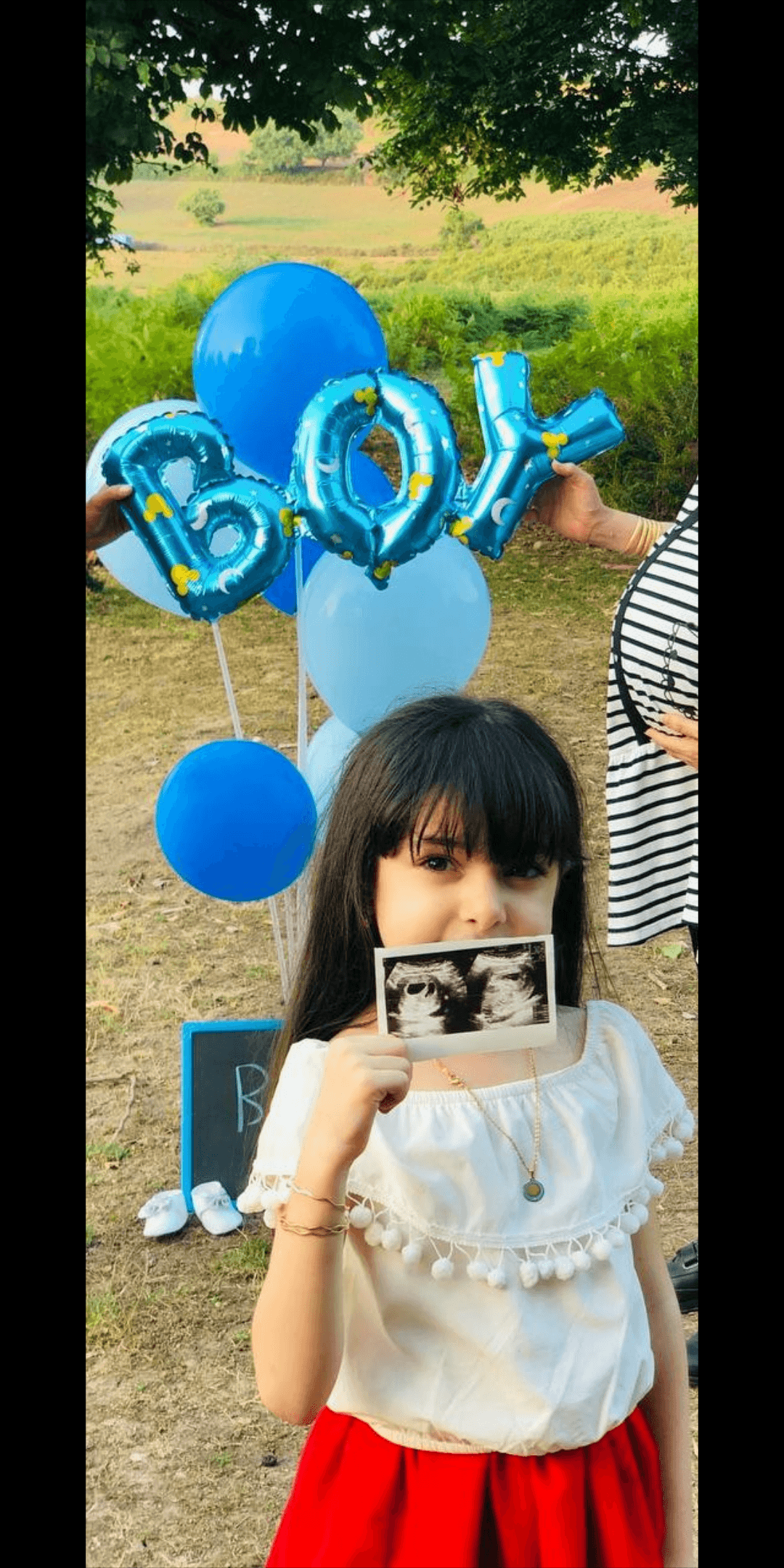 متولد شدن نوزاد آرنیک و نیکان