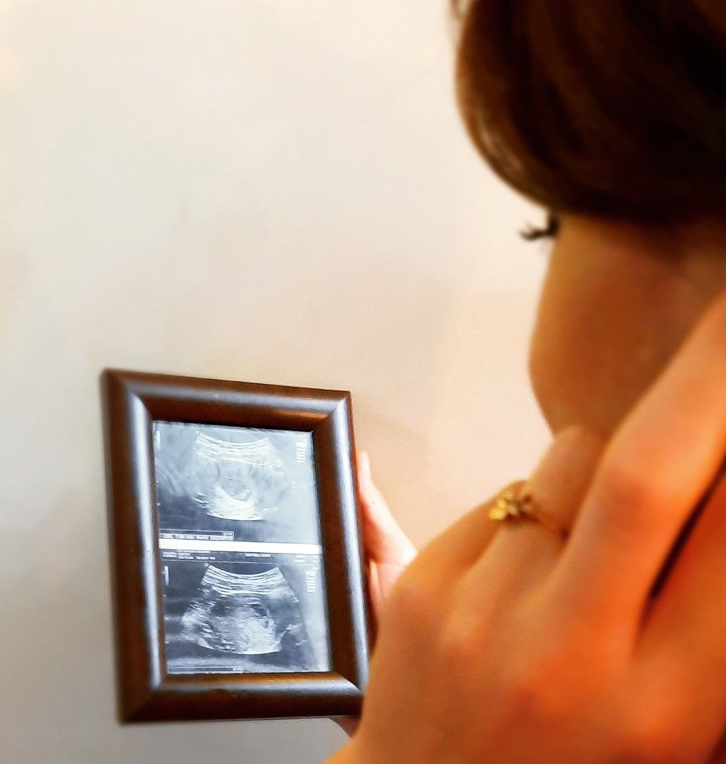 عکس نوزاد پسر مهراد