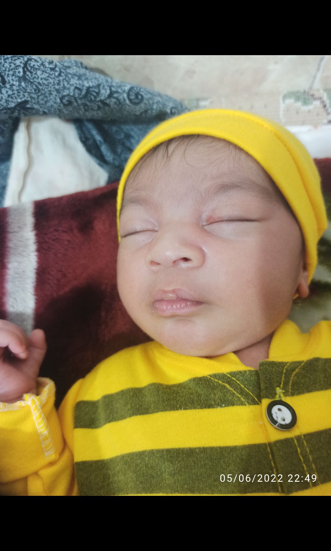 اجزای-صورت محمدمهدیارآزادگرمی