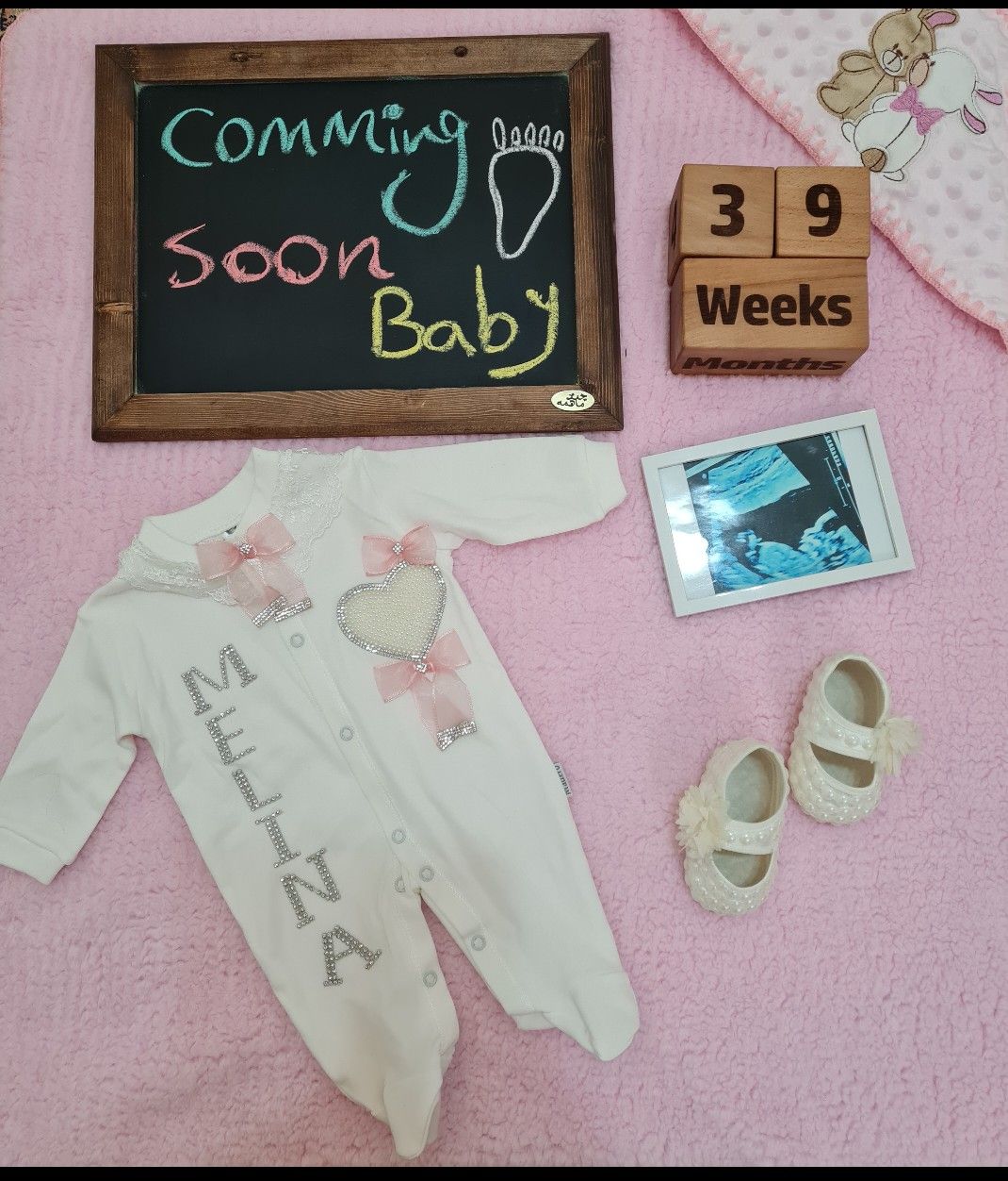 بارداری ملینا