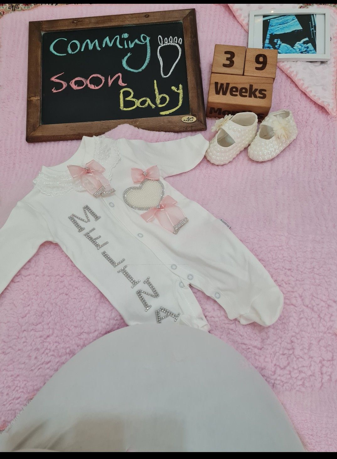 بارداری ملینا