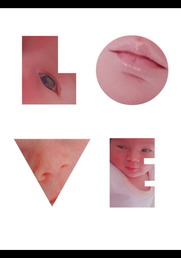 اجزای-صورت امیرحسین میرزایی