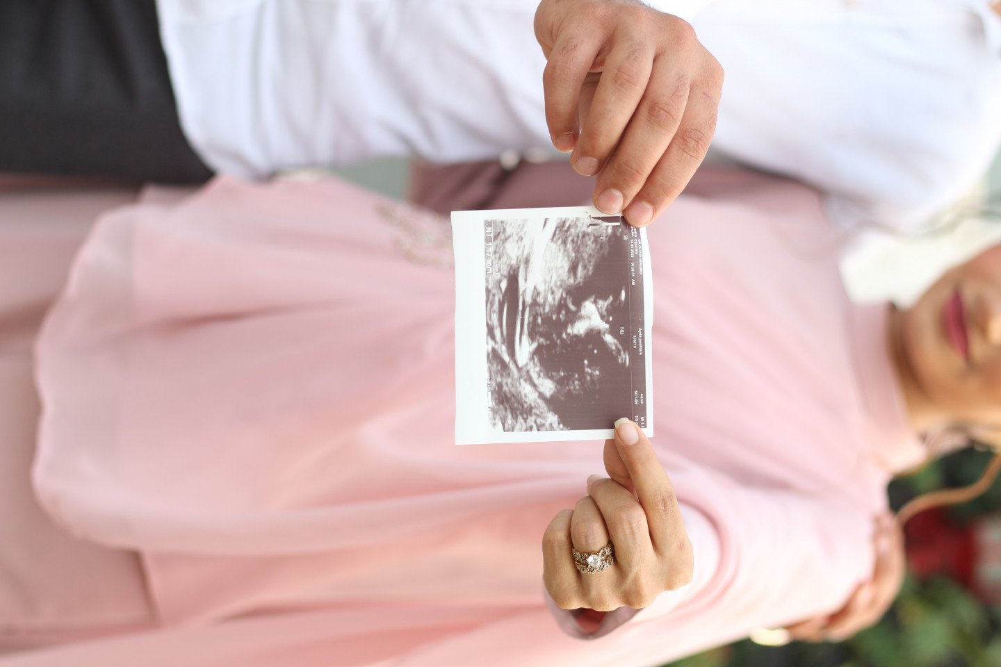 بارداری آرکان روانتاب